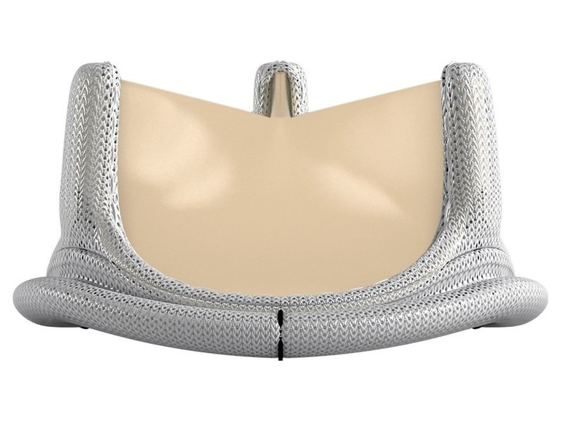 Magna Ease Tissue Valve